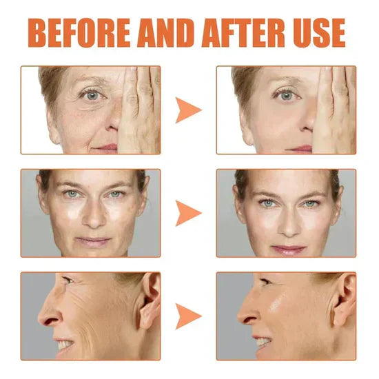 đLast Day Promotion 70% OFFđ-Clostridium botulinum Face Serum