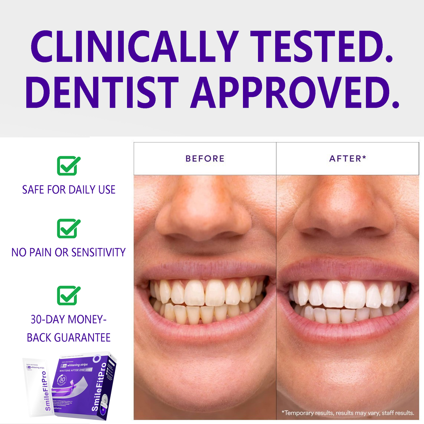 SmileFitPro™ V36 Whitening Strips – Professional Teeth Whitening at Home