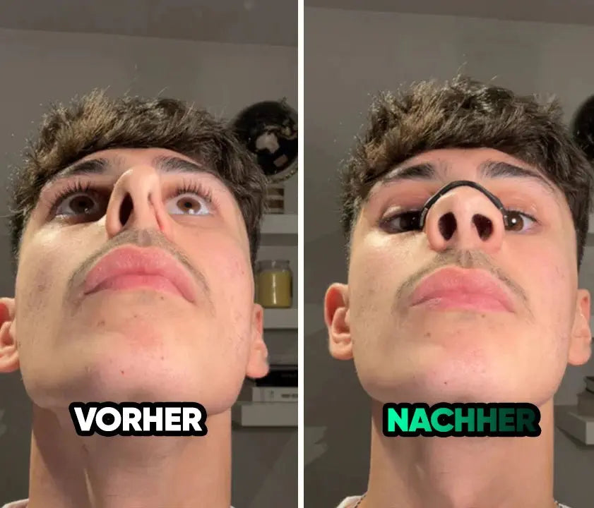 Magnetic Nose Patch
