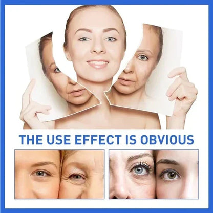 🎁Last Day Promotion 70% OFF🎁-Clostridium botulinum Face Serum