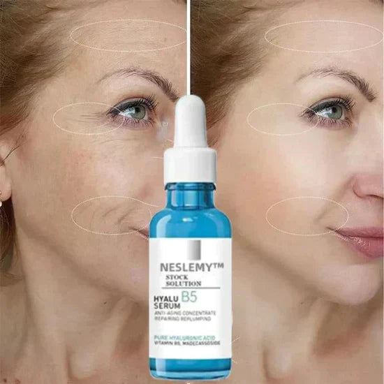 🎁Last Day Promotion 70% OFF🎁-Clostridium botulinum Face Serum