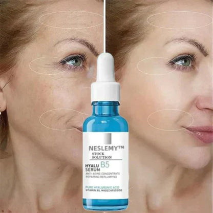 🎁Last Day Promotion 70% OFF🎁-Clostridium botulinum Face Serum
