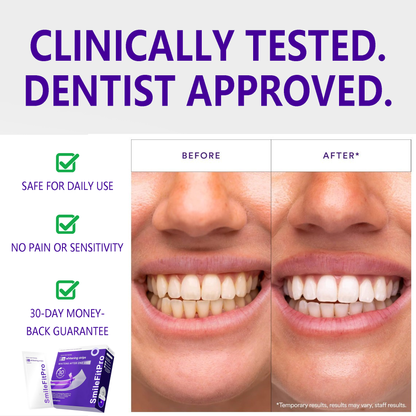 SmileFitPro™ V36 Whitening Strips – Professional Teeth Whitening at Home