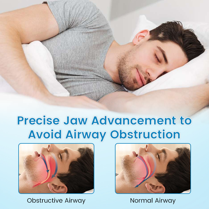 QIAWI™ Anti-Snoring Guard