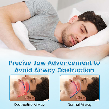 QIAWI™ Anti-Snoring Guard