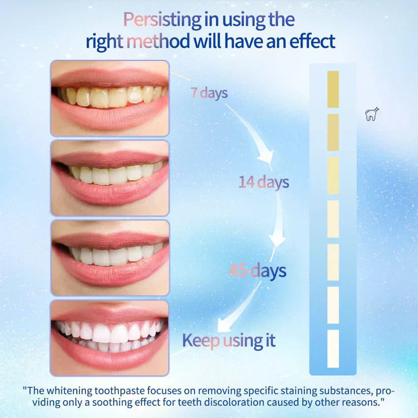 🔥 LOVILDS™ Niacinamide Whitening Toothpaste
